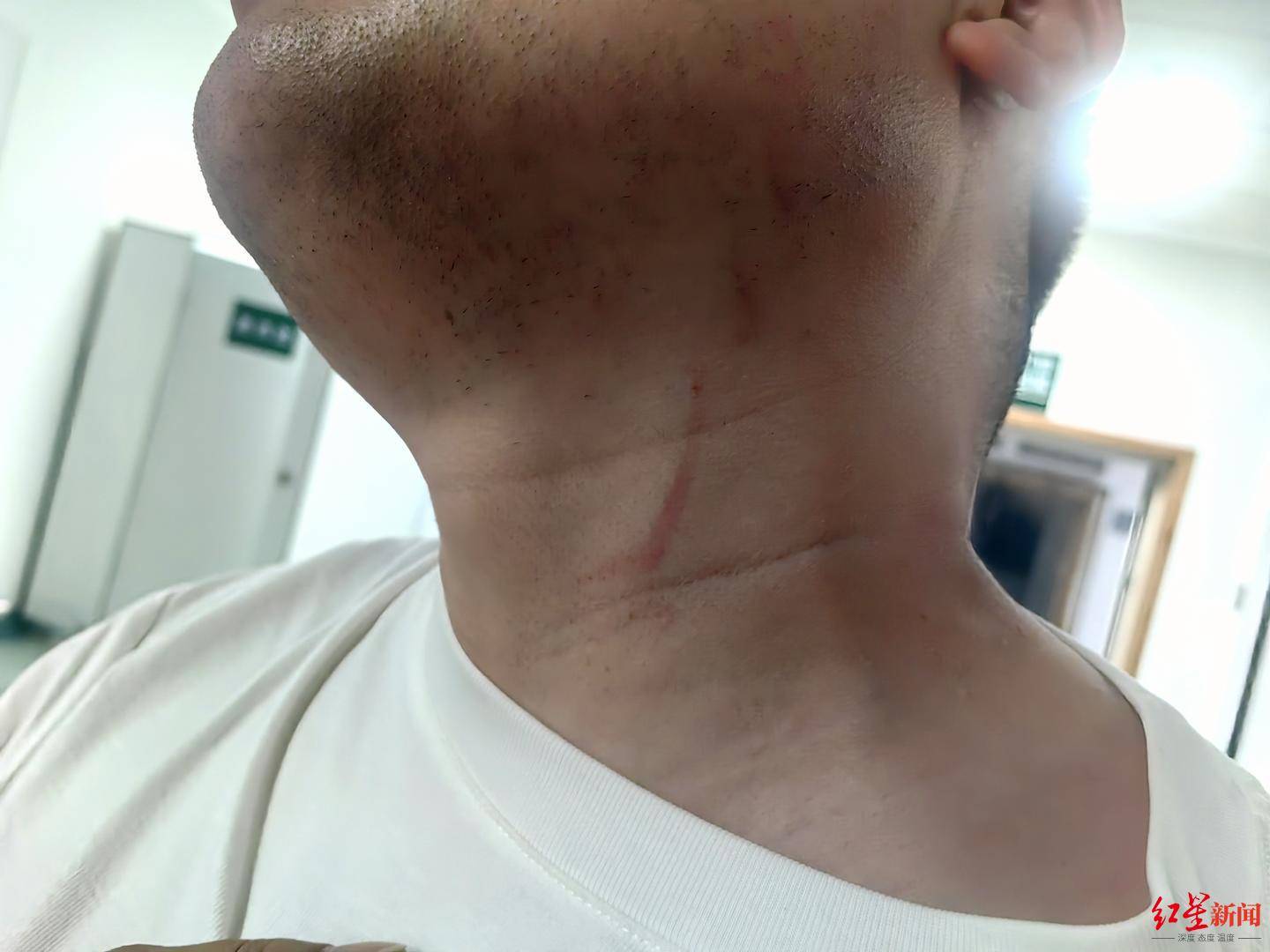 皇冠信用盘结算日是哪天
_武汉男子拍摄违停时被当街殴打皇冠信用盘结算日是哪天
,打人者被罚款500元,被打者称将提起行政复议并起诉